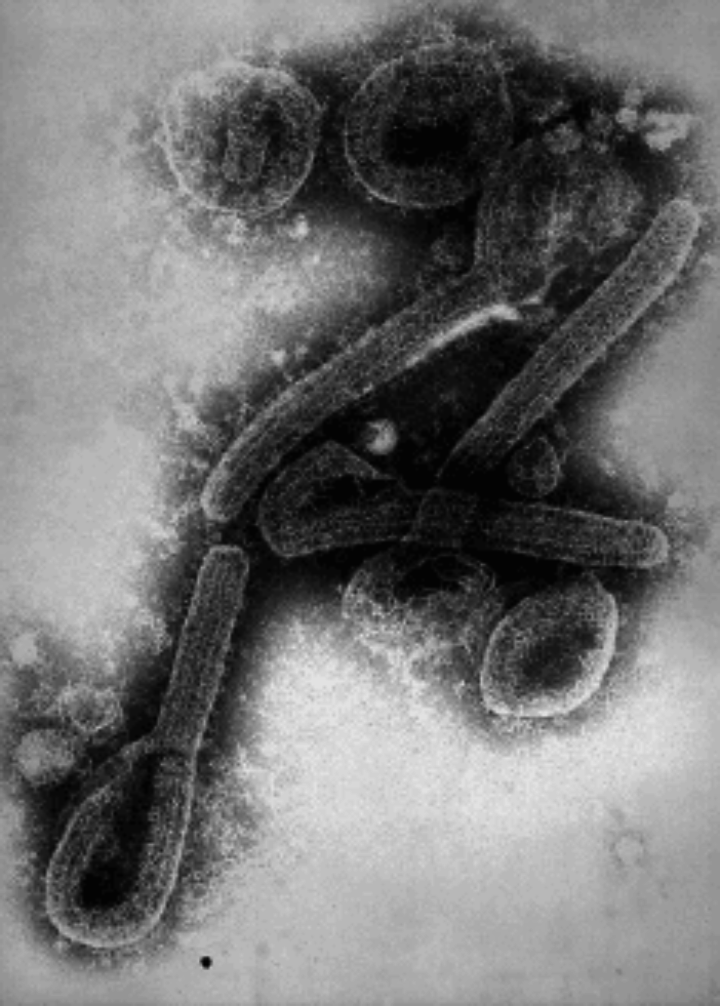 Elektronenmikroskopische Darstellung des Marburg-Virus